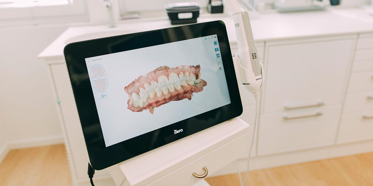 Detailaufnahme eines Iteroscanners in der Zahnarztpraxis Emma Klein in Rastede